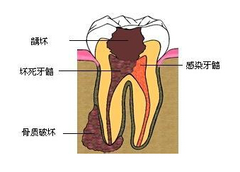 財ӦעЩ?